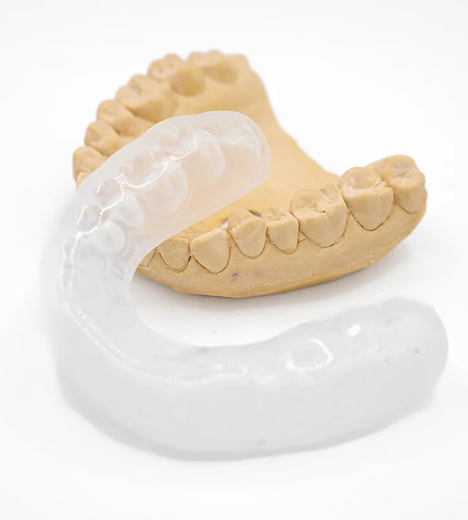Clear custom mouthguard on a dental model