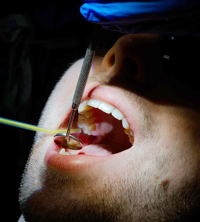 Close-up of a patient’s open mouth during a dental examination